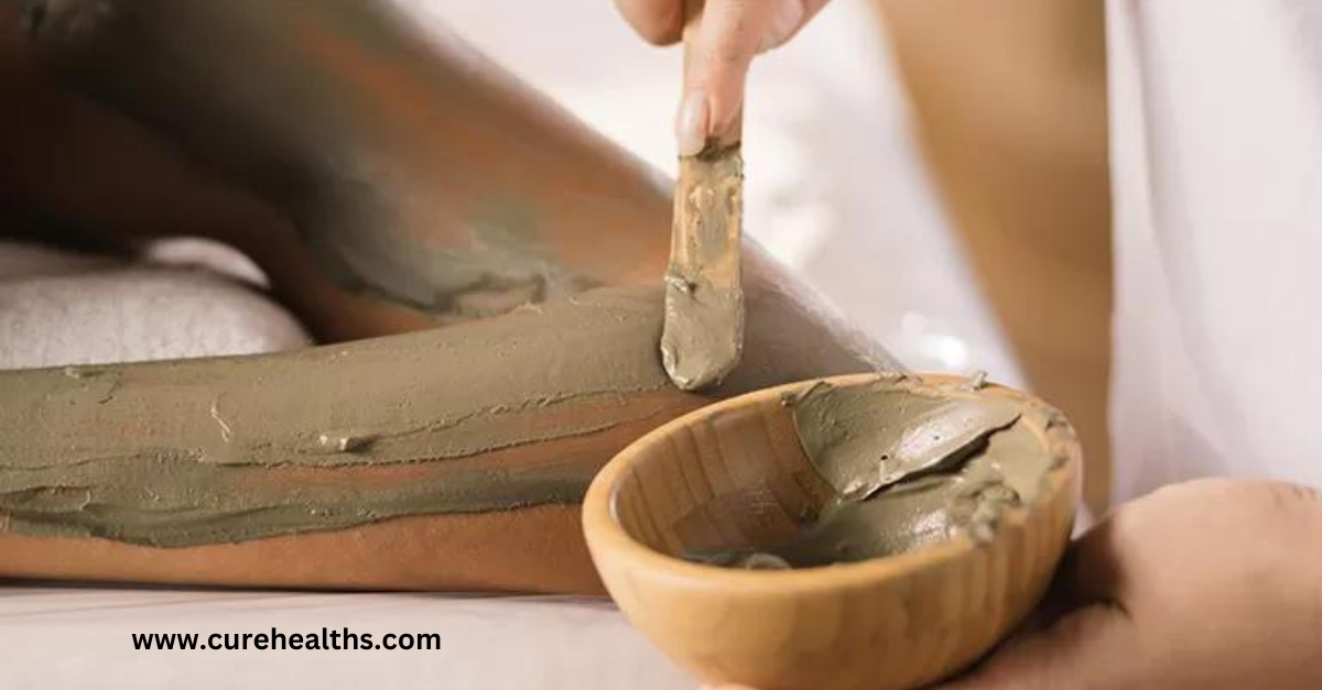 5 Surprising Benefits of Naturopathic Mud Therapy